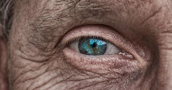 THEY ARE NOT JUST SIGN OF AGING: Wrinkles reveal your personality and health problem you've got