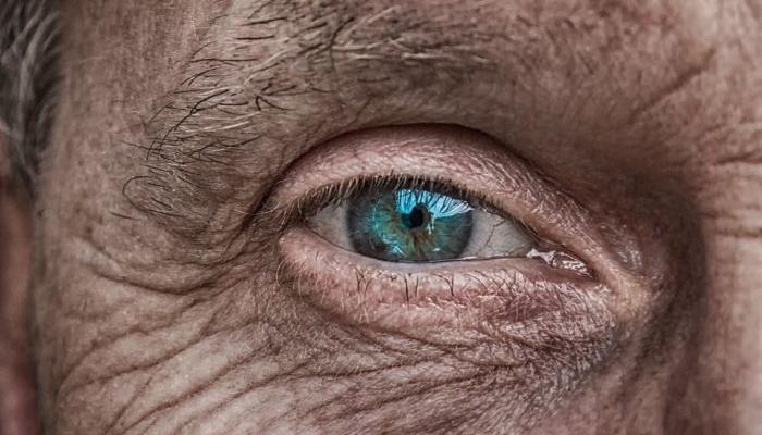 THEY ARE NOT JUST SIGN OF AGING: Wrinkles reveal your personality and health problem you've got